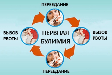 Лечение булимии в Большие Вязёмы